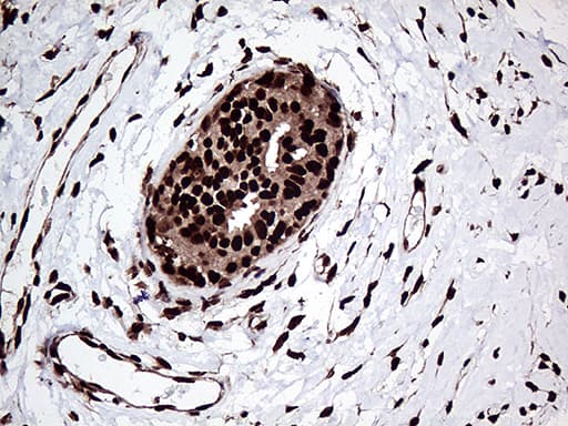 ZRANB2 / ZNF265 Antibody (aa95-320, clone OTI2E3, Carrier-free)