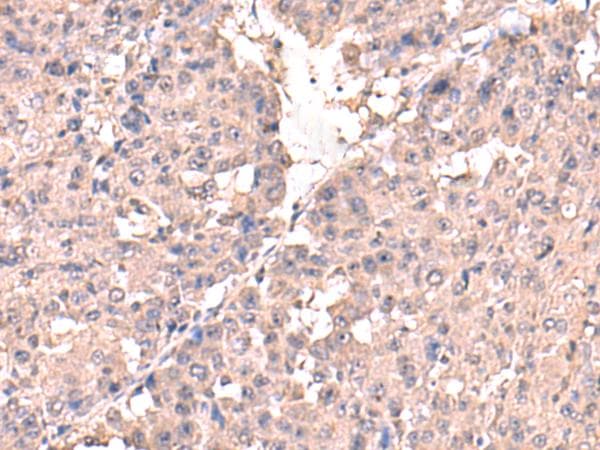 HPN / TMPRSS1 / Hepsin Antibody