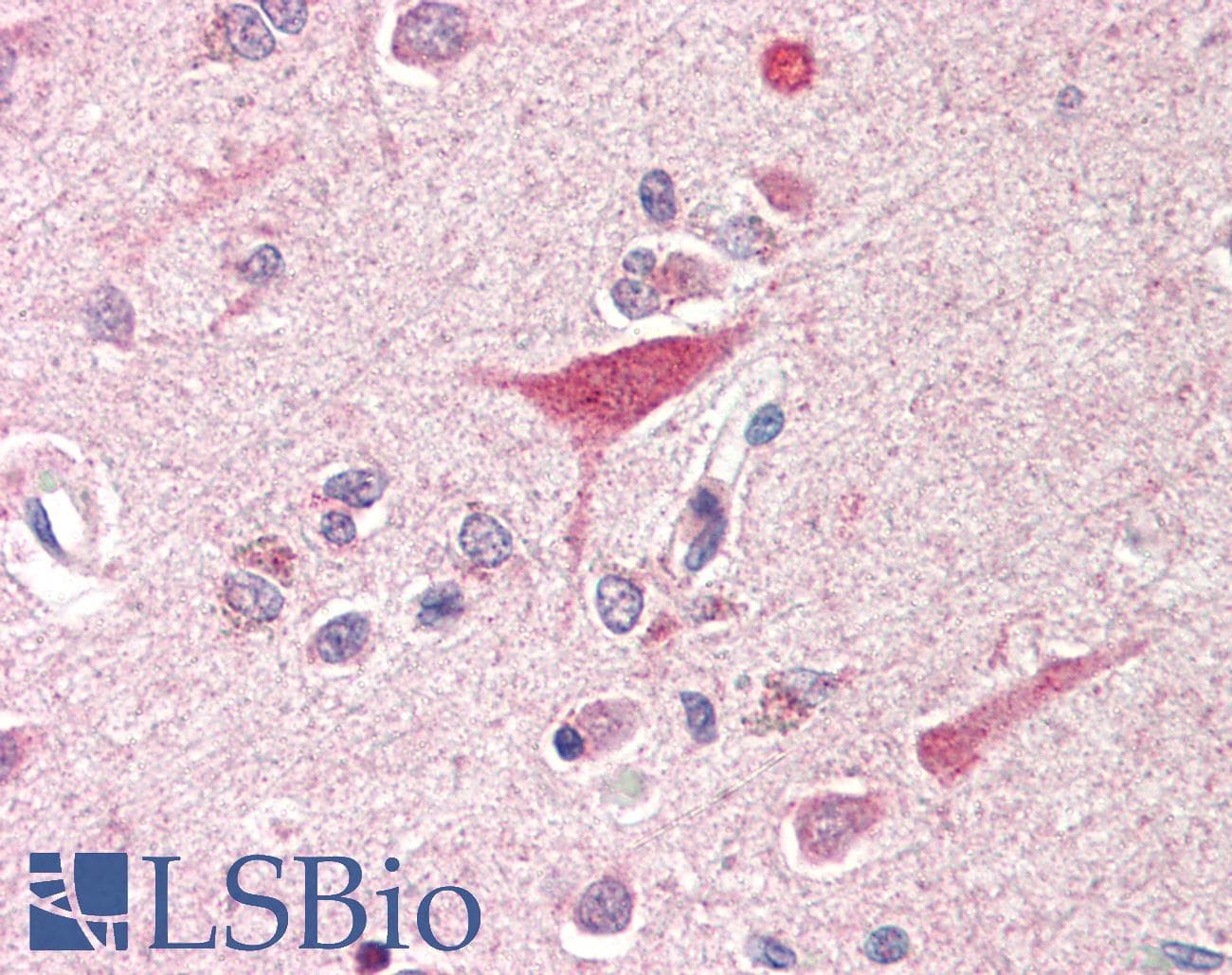 IHC-plus™ SSTR1 Antibody (C-Terminus)