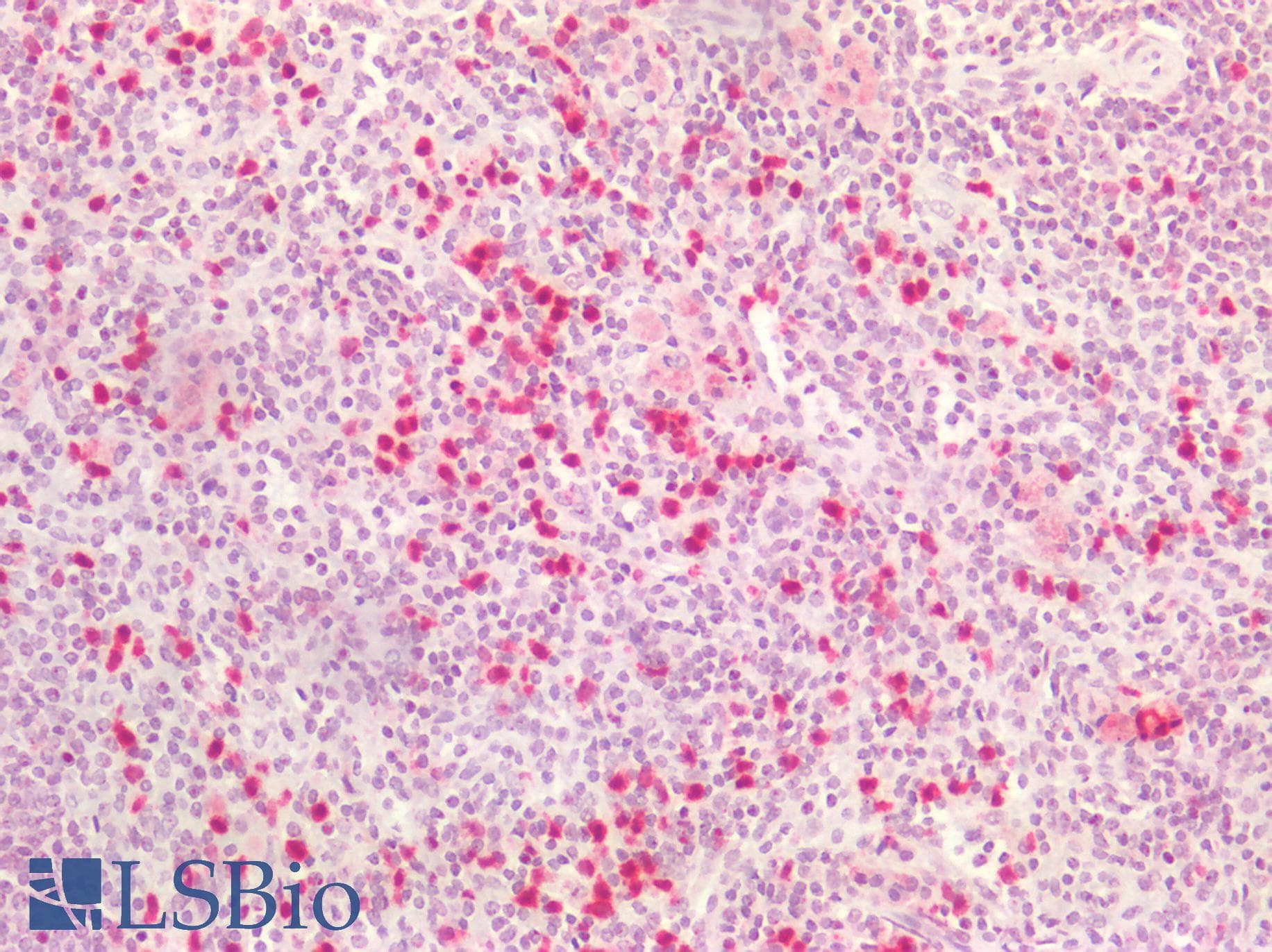 IHC-plus™ Monoclonal Mouse anti-Human S100A8 / MRP8 Antibody (clone CF-145, FITC, IHC, IF, WB)