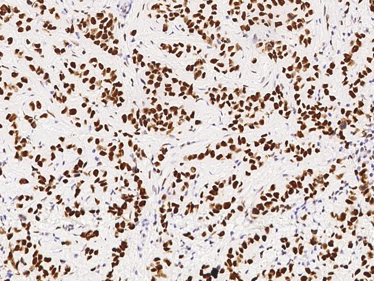 PSME3 Antibody (Preservative Free)