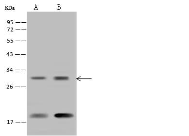 Polyclonal Rabbit anti-Human RPS23 / Ribosomal Protein S23 Antibody (WB)