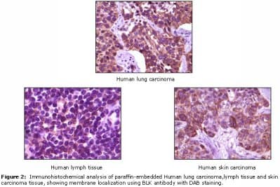 Monoclonal Mouse anti-Human BLK Antibody (clone 9D10B7H6, 9D10A8F8, IHC, WB)