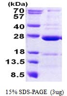 Human CCDC90B Protein (Recombinant His)