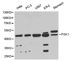Polyclonal Rabbit anti-Human PGK1 / Phosphoglycerate Kinase Antibody (IHC, WB)