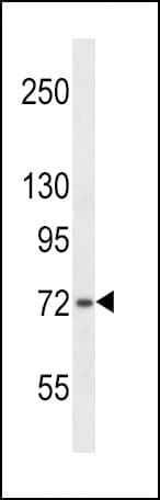 SH2B1 Antibody (aa725-752)