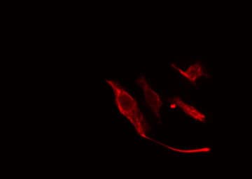Polyclonal Rabbit anti-Human VTI1A Antibody (IF, WB)