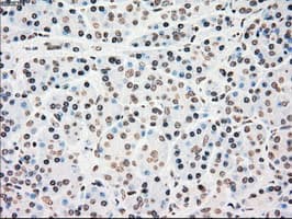 CHEK2 / CHK2 Antibody (clone OTI5C4)
