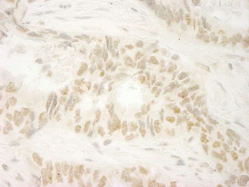 MKRN1 Antibody (aa432-C-term)