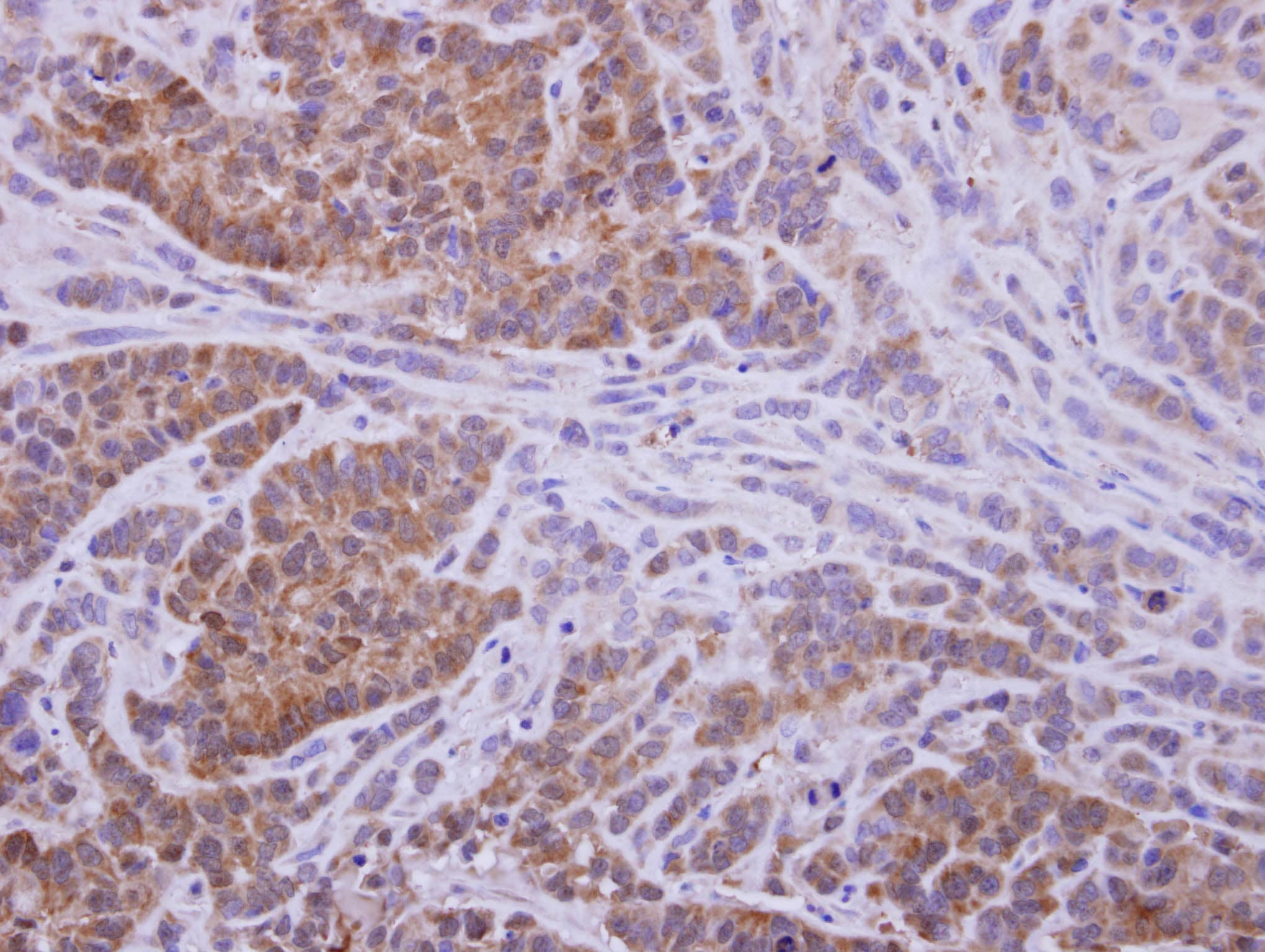 AKR1D1 Antibody
