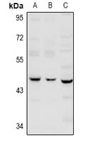 Polyclonal Rabbit anti-Human SERPINB12 Antibody (WB)