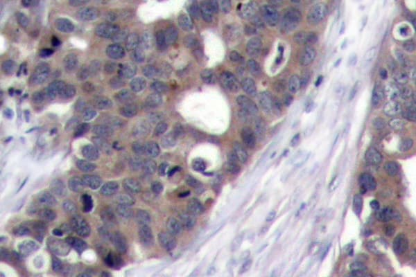 RPS6KB1 / P70S6K / S6K Antibody (Phe428)