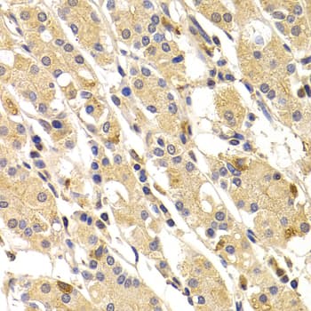 TNNI3 / Cardiac Troponin I Antibody