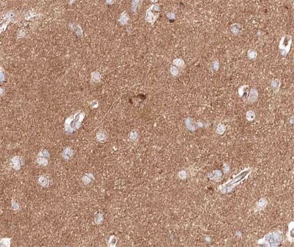 CTTN / Cortactin Antibody (phospho-Tyr466)