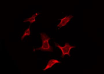 SIPR2 / S1P2 / EDG5 Antibody