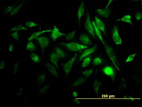 IHC-plus™ Monoclonal Mouse anti-Human RAB3B Antibody (clone 3F12, IHC, IF, WB)