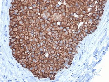 ERBB2 / HER2 Antibody (clone ERBB2/3092, Ready-to-Use)