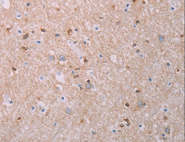 Polyclonal Rabbit anti-Human AKT2 Antibody (IHC)