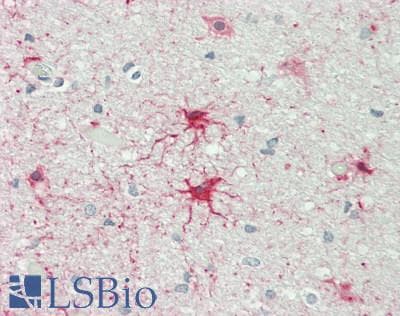 IHC-plus™ ADCY1 / Adenylate Cyclase 1 Antibody (aa230-280)