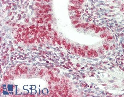 IHC-plus™ HNRNPA2B1 Antibody