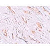 Polyclonal Rabbit anti-Human PEAR1 Antibody (IHC, IF, WB)