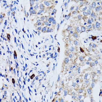Polyclonal Rabbit anti-Human MAP1LC3B / LC3B Antibody (IHC, WB)