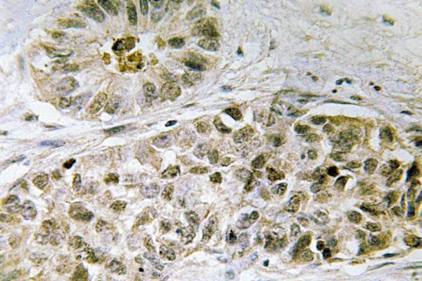 SDCCAG1 / NEMF Antibody (Lys914)