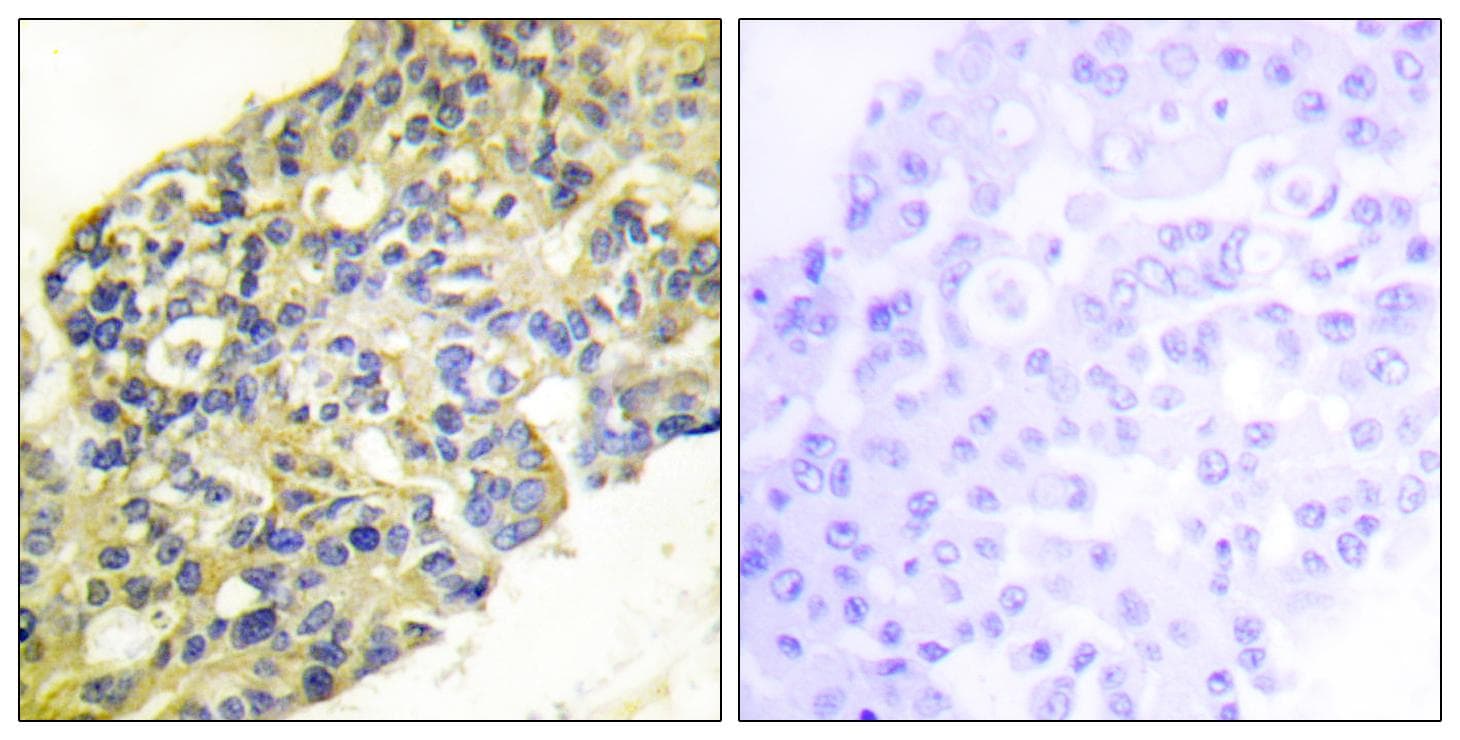 PIK3R1 / p85 Alpha Antibody (p467/199)
