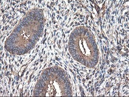 TUBAL3 Antibody (clone OTI4D8)
