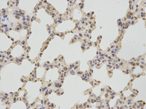IHC-plus™ TS / Thromboxane Synthase Antibody