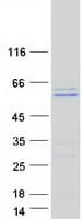 Human TMPO / TP / Thymopoietin Protein (Recombinant Myc-DDK (Flag))