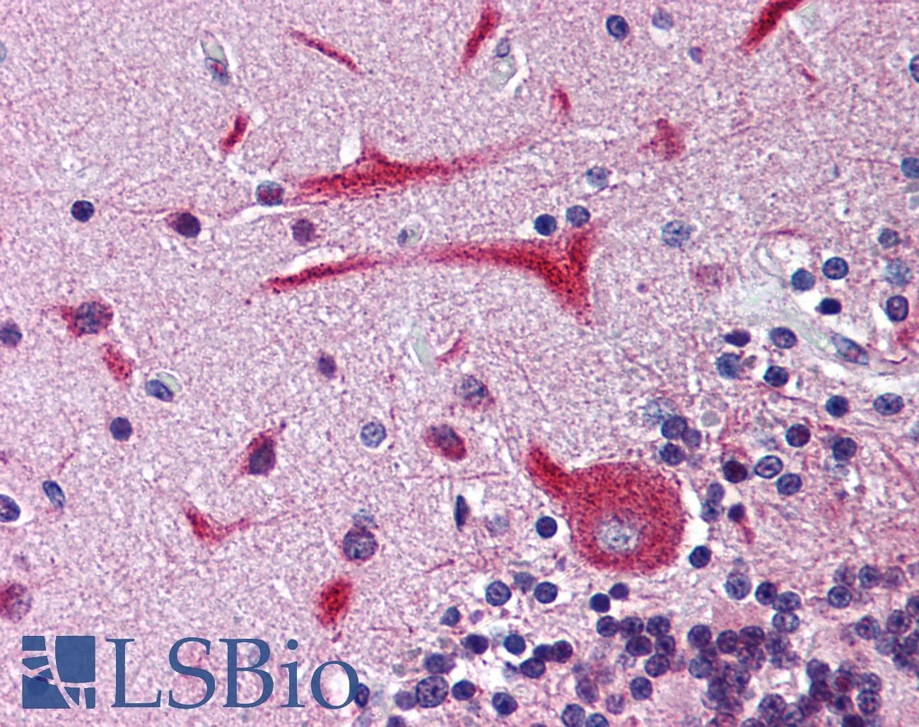 IHC-plus™ KCNH2 / HERG Antibody (Internal)