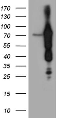 Monoclonal Mouse anti-Human ABCF2 Antibody (clone OTI5D5, Carrier-free, aa1-235, WB)