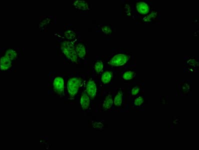 HIWI2 / PIWIL4 Antibody