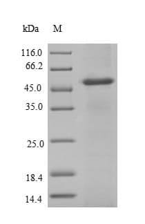 Human NCBP2 / CBP20 Protein (Recombinant GST, N-terminus)