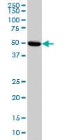 Monoclonal Mouse anti-Human PRKAR2A Antibody (clone 6A9, IHC, IF, WB)