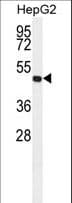 ALDH3A2 Antibody