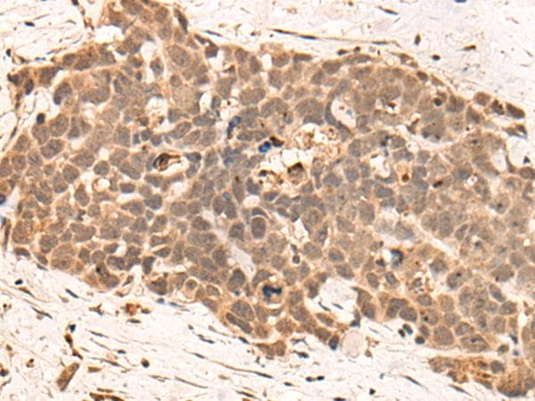 Polyclonal Rabbit anti-Human CLK2 Antibody (IHC)