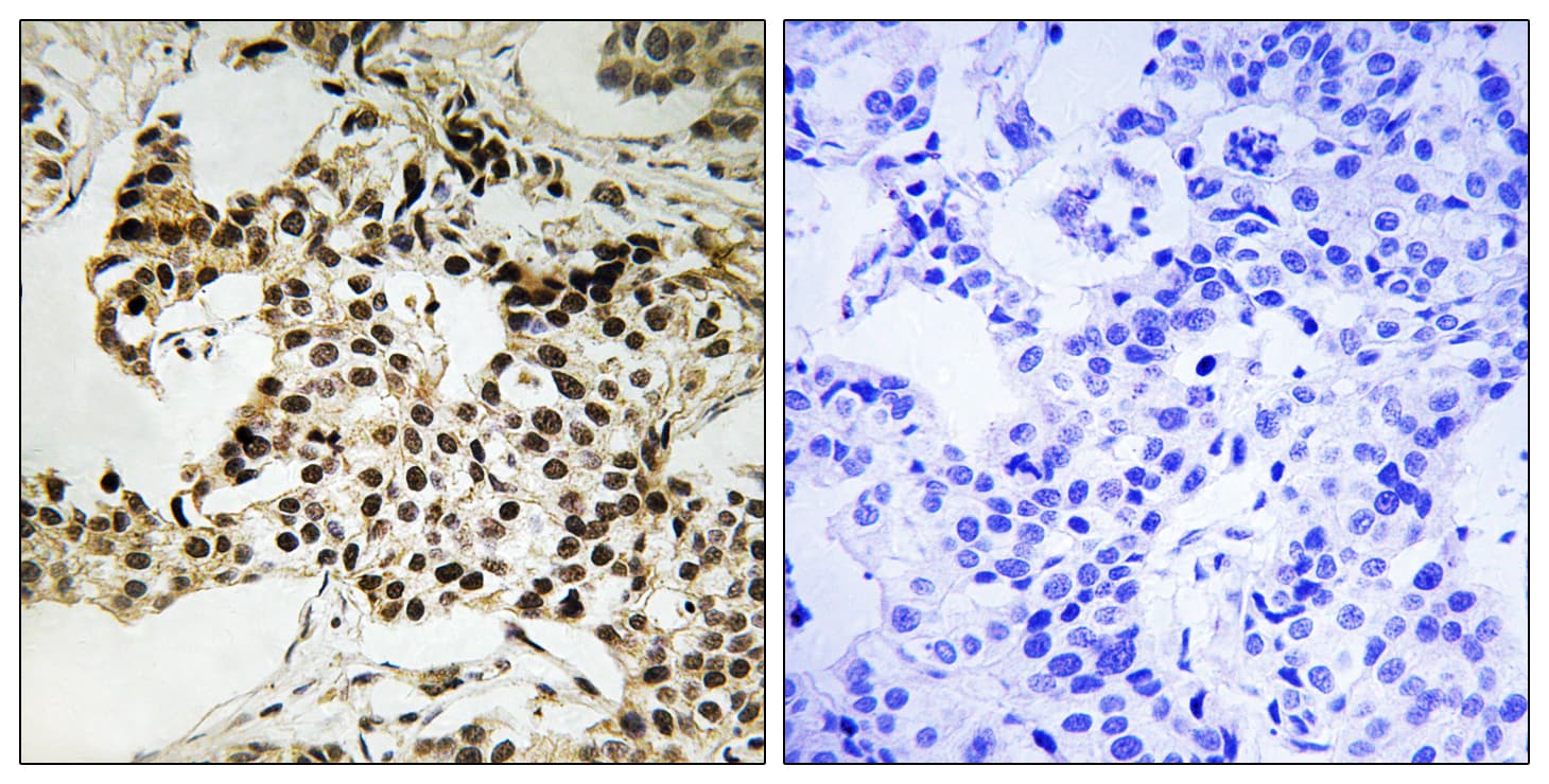 EIF2AK2 / PKR Antibody (phospho-Thr258)