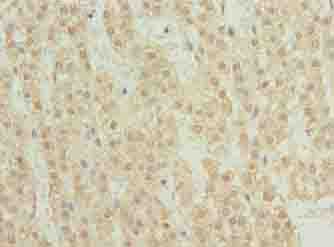 Polyclonal Rabbit anti-Human TRM6 / TRMT6 Antibody (IHC, WB)