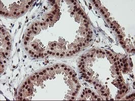 TP53 / p53 Antibody (clone OTI2H6, Carrier-free)
