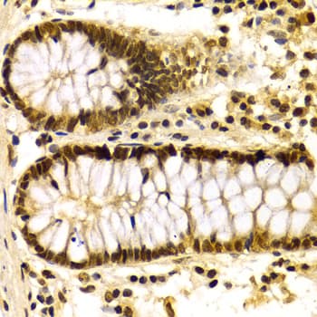 QIP1 / KPNA4 Antibody