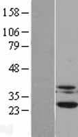 CSNK2B / Phosvitin Protein (Over-Expression Lysate Myc-DDK (Flag))