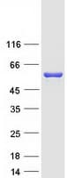 Human DUS2 / DUS2L Protein (Recombinant Myc-DDK (Flag))
