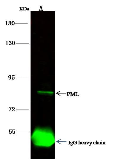 PML Antibody (Preservative Free)