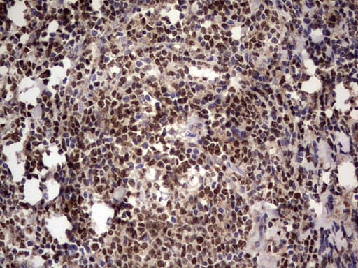 IKZF3 / AIOLOS Antibody (aa1-301, clone OTI7E11, Carrier-free)