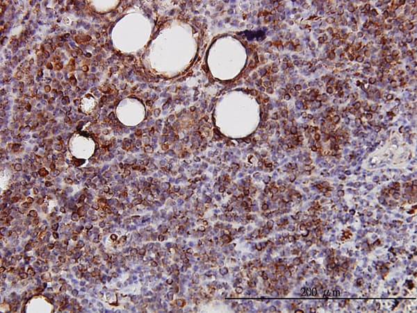 SPRY2 / Sprouty 2 Antibody (clone 1E10)
