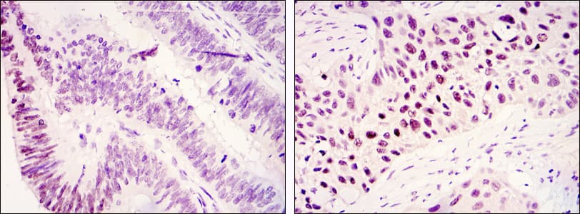 KDM3A / JMJD1A Antibody (clone 1E+12)