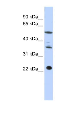 Polyclonal Rabbit anti-Human CENPM Antibody (C-Terminus, WB)