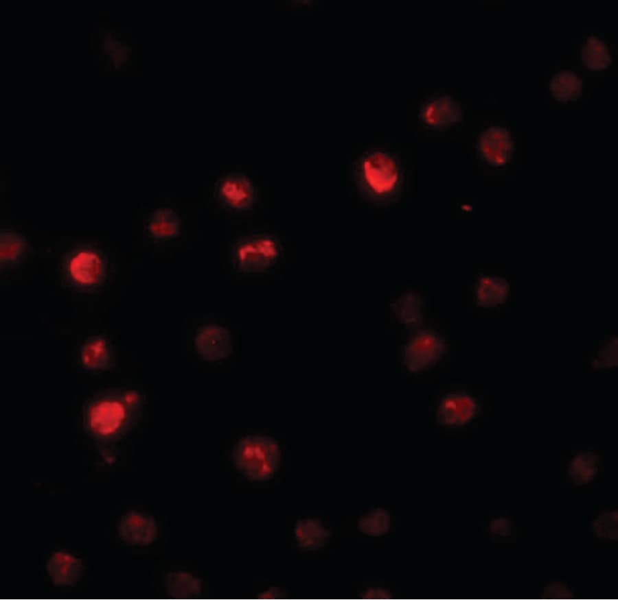 IHC-plus™ Polyclonal Rabbit anti-Human PPAPDC2 Antibody (IHC, IF, WB)